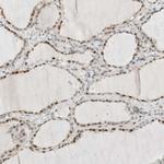 METTL11B Antibody in Immunohistochemistry (IHC)