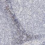 METTL11B Polyclonal Antibody