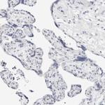 METTL11B Antibody in Immunohistochemistry (IHC)
