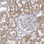 LYSMD1 Antibody in Immunohistochemistry (Paraffin) (IHC (P))