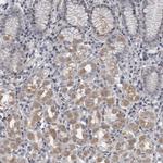LYSMD1 Antibody in Immunohistochemistry (Paraffin) (IHC (P))