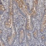 LYSMD1 Antibody in Immunohistochemistry (Paraffin) (IHC (P))