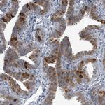 LRRC6 Polyclonal Antibody