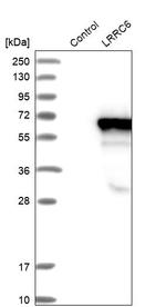 LRRC6 Antibody in Western Blot (WB)