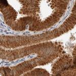 DYRK4 Antibody in Immunohistochemistry (IHC)