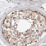 DYRK4 Antibody in Immunohistochemistry (IHC)