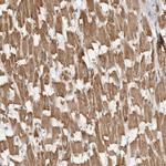 MAP7D1 Antibody in Immunohistochemistry (IHC)