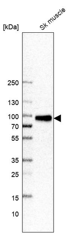 AMPD1 Antibody in Western Blot (WB)
