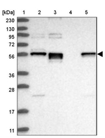 ERO1LB Antibody in Western Blot (WB)