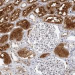 RAB11FIP3 Polyclonal Antibody