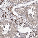 MRPS15 Antibody in Immunohistochemistry (IHC)