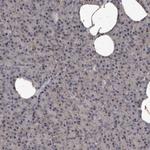 MRPS15 Antibody in Immunohistochemistry (IHC)