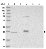 MRPS15 Antibody in Western Blot (WB)