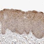 TUFT1 Polyclonal Antibody
