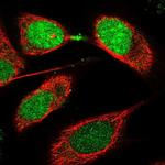 CDCA8 Polyclonal Antibody