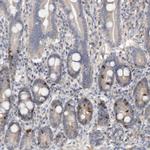 CDCA8 Antibody in Immunohistochemistry (Paraffin) (IHC (P))