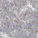 PARP10 Polyclonal Antibody