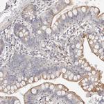 MYOM3 Polyclonal Antibody