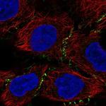 PLEKHA6 Polyclonal Antibody