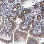 PLEKHA6 Antibody in Immunohistochemistry (Paraffin) (IHC (P))