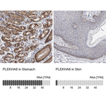PLEKHA6 Antibody in Immunohistochemistry (Paraffin) (IHC (P))