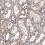 PLEKHA6 Antibody in Immunohistochemistry (Paraffin) (IHC (P))
