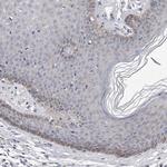 PLEKHA6 Antibody in Immunohistochemistry (Paraffin) (IHC (P))