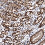 PLEKHA6 Antibody in Immunohistochemistry (Paraffin) (IHC (P))