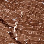 ZYG11B Antibody in Immunohistochemistry (Paraffin) (IHC (P))