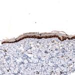ZYG11B Antibody in Immunohistochemistry (Paraffin) (IHC (P))
