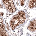 ZYG11B Antibody in Immunohistochemistry (Paraffin) (IHC (P))