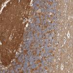 WDTC1 Polyclonal Antibody