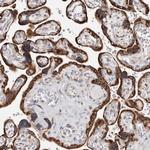 ACBD6 Polyclonal Antibody