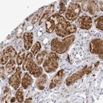 WDTC1 Antibody in Immunohistochemistry (Paraffin) (IHC (P))