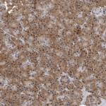 WDTC1 Antibody in Immunohistochemistry (Paraffin) (IHC (P))