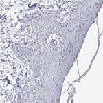 WDTC1 Antibody in Immunohistochemistry (Paraffin) (IHC (P))
