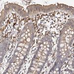 WDTC1 Antibody in Immunohistochemistry (IHC)
