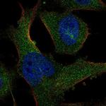 SASS6 Polyclonal Antibody