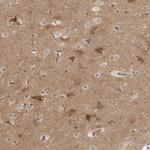 SRGAP2 Antibody in Immunohistochemistry (IHC)