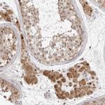 SRGAP2 Antibody in Immunohistochemistry (Paraffin) (IHC (P))