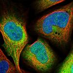 FDPS Polyclonal Antibody