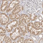 FDPS Antibody in Immunohistochemistry (Paraffin) (IHC (P))