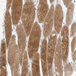 TMOD4 Polyclonal Antibody
