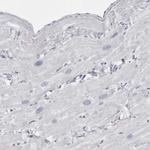 TMOD4 Antibody in Immunohistochemistry (IHC)