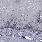 NVL Polyclonal Antibody