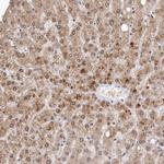 SULT1E1 Polyclonal Antibody