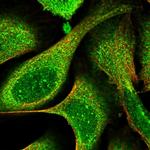 eIF2d Polyclonal Antibody