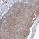 eIF2d Antibody in Immunohistochemistry (Paraffin) (IHC (P))