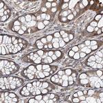 eIF2d Antibody in Immunohistochemistry (Paraffin) (IHC (P))