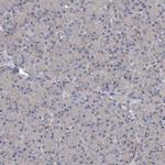 eIF2d Antibody in Immunohistochemistry (Paraffin) (IHC (P))
